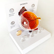 Load image into Gallery viewer, 4X Human Pvc Eye Cataract Anatomy Medical Teaching Model
