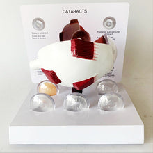 Load image into Gallery viewer, 4X Human Pvc Eye Cataract Anatomy Medical Teaching Model
