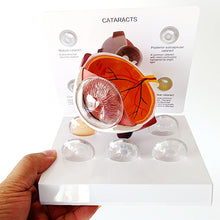Load image into Gallery viewer, 4X Human Pvc Eye Cataract Anatomy Medical Teaching Model
